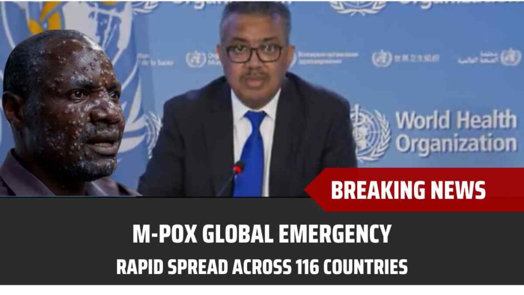 M-Pox global health emergency spreading across 116 countries